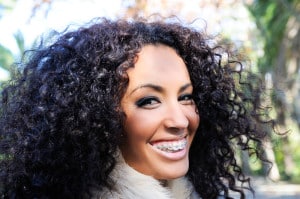 A woman with braces shows of her smile