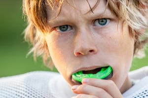 Athletic Mouthwear