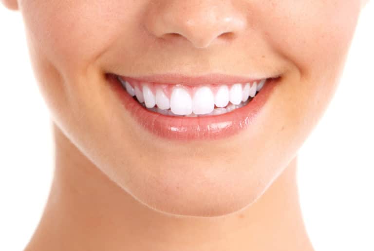 Invisalign Ottawa