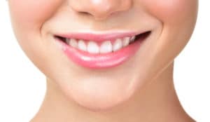 Closeup of a woman's smile