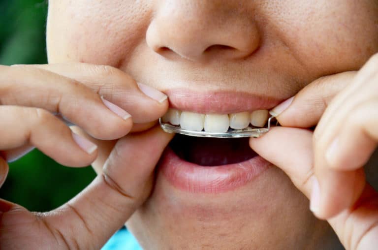 retainers in ottawa