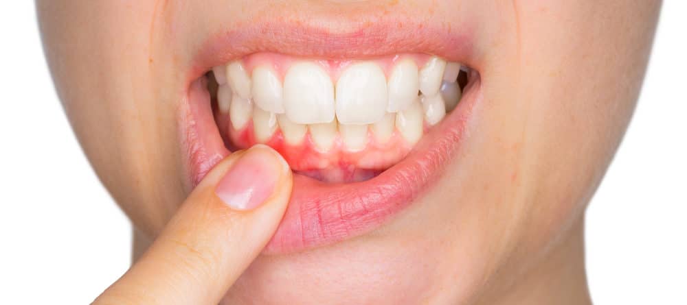 your gums are as important as your teeth