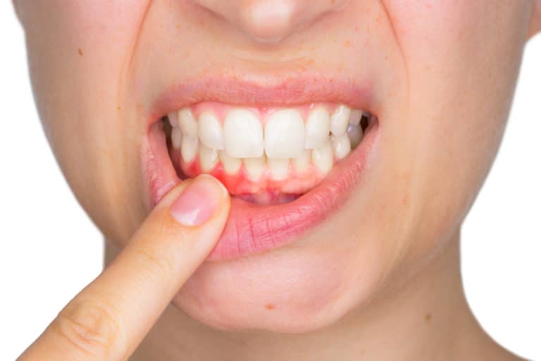 your gums are as important as your teeth