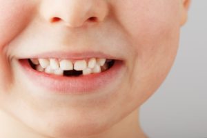 Everyone Lose Their Baby Teeth