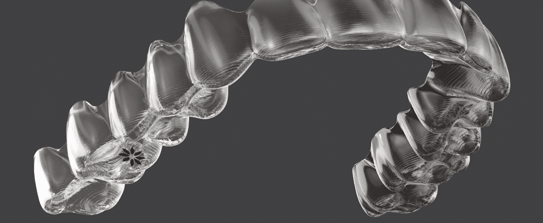 Myths about Invisalign