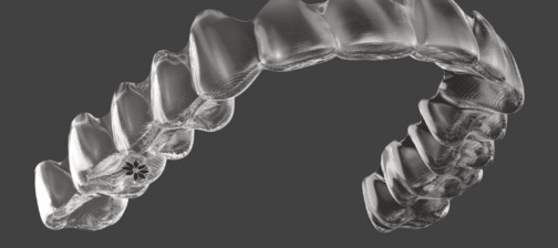 Myths about Invisalign