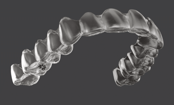 Myths about Invisalign