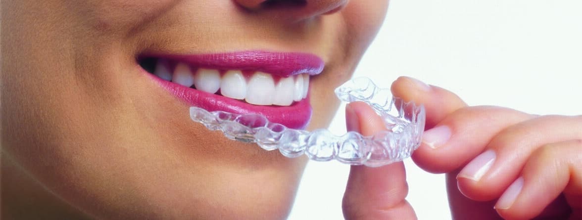 Invisalign During the holidays