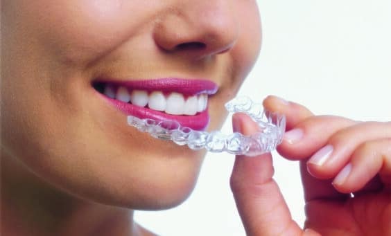 Invisalign During the holidays