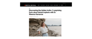 dental implants article