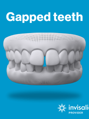 gapped teeth