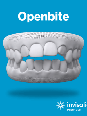 Openbite