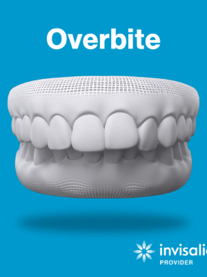 Overbite