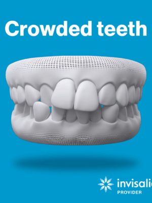 crowded teeth