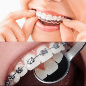 Orthodontics Nepean