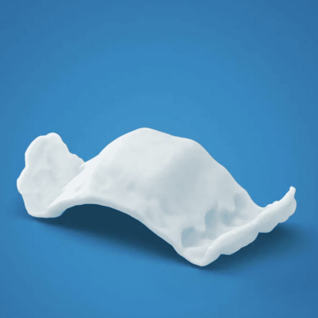 Invisalign Palatal Expander