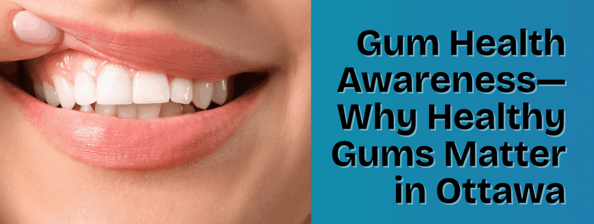 - gum health Ottawa