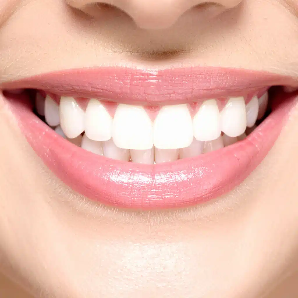 The Teal Umbrella - Cosmetic Bonding